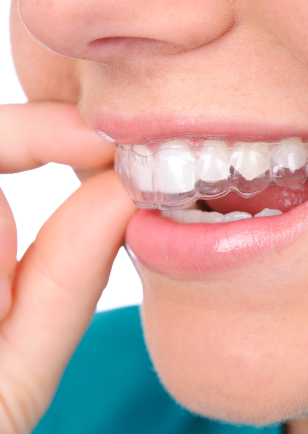 Drs Ngema & Dubula Orthodontist’s Orthodontist near me The best orthodontist Orthodontist in Alberton Orthodontist in Sandton Orthodontist in Midrand Orthodontist in Boksburg Orthodontist in Randburg Orthodontist in Kimberly Orthodontist in Lynnwood Pretoria PTA Orthodontist in Montana Pretoria PTA Orthodontist South Africa Orthodontist Ortho straight teeth straighten teeth braces